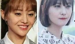 开心果爆料整容视频播放,揭秘明星蜕变之路